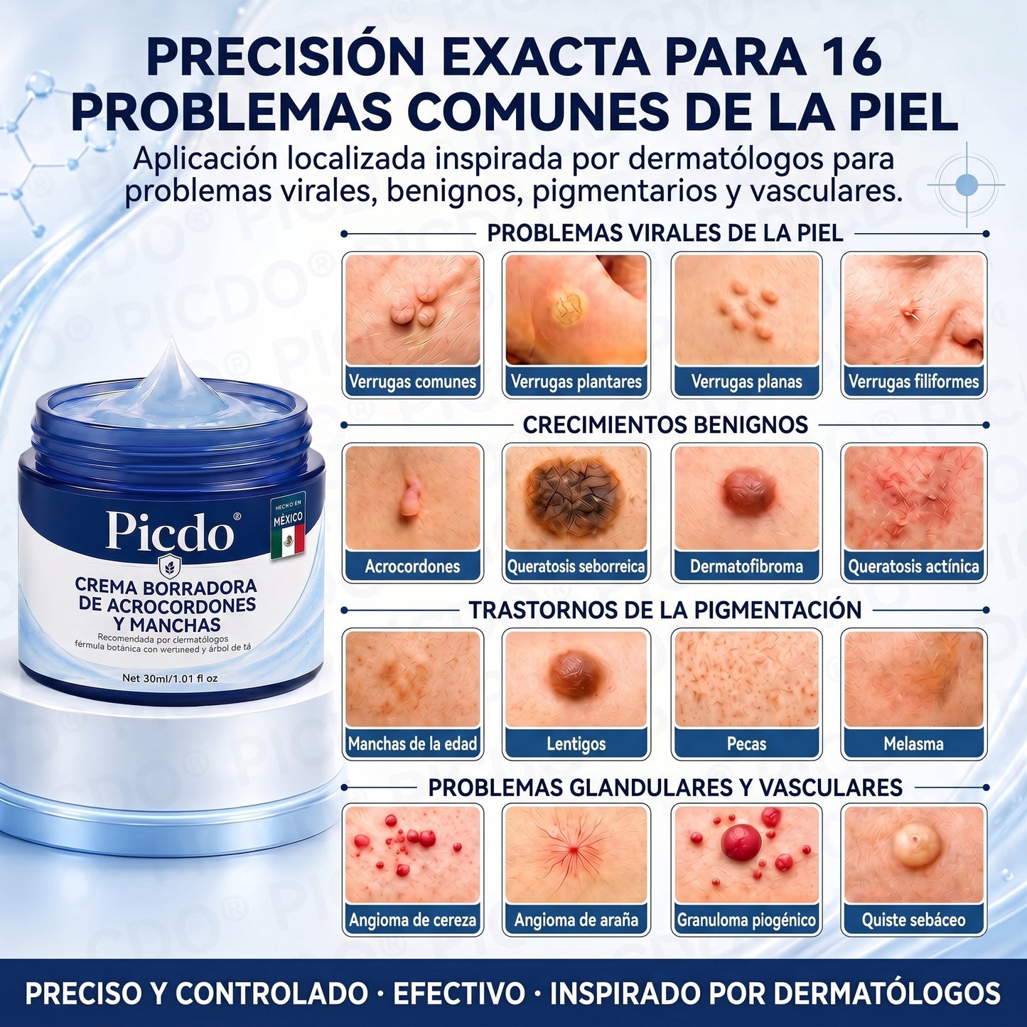 🌌𝐏𝐢𝐜𝐝𝐨® 𝑪𝒓𝒆𝒎𝒂 𝑩𝒐𝒓𝒓𝒂𝒅𝒐𝒓𝒂 𝒅𝒆 𝑨𝒄𝒓𝒐𝒄𝒐𝒓𝒅𝒐𝒏𝒆𝒔 𝒚 𝑴𝒂𝒏𝒄𝒉𝒂𝒔 𝒆𝒏 7 𝑫í𝒂𝒔🩵 (𝐹ó𝑟𝑚𝑢𝑙𝑎 𝑠𝑖𝑛 𝑑𝑜𝑙𝑜𝑟 𝑛𝑖 𝑐𝑖𝑐𝑎𝑡𝑟𝑖𝑐𝑒𝑠) 💪