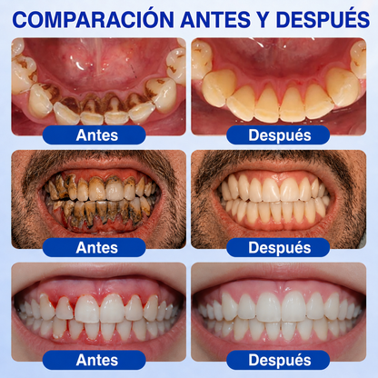 🌌𝑲𝒆𝒚𝒆𝒔𝒔®𝑮𝒖𝒎𝑹𝒆𝒗𝒊𝒗𝒆 𝑮𝒆𝒍 𝑹𝒆𝒑𝒂𝒓𝒂𝒅𝒐𝒓 𝑷𝒆𝒓𝒊𝒐𝒅𝒐𝒏𝒕𝒂𝒍
