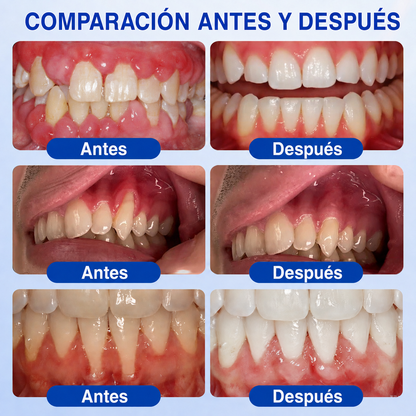 🌌𝑲𝒆𝒚𝒆𝒔𝒔®𝑮𝒖𝒎𝑹𝒆𝒗𝒊𝒗𝒆 𝑮𝒆𝒍 𝑹𝒆𝒑𝒂𝒓𝒂𝒅𝒐𝒓 𝑷𝒆𝒓𝒊𝒐𝒅𝒐𝒏𝒕𝒂𝒍
