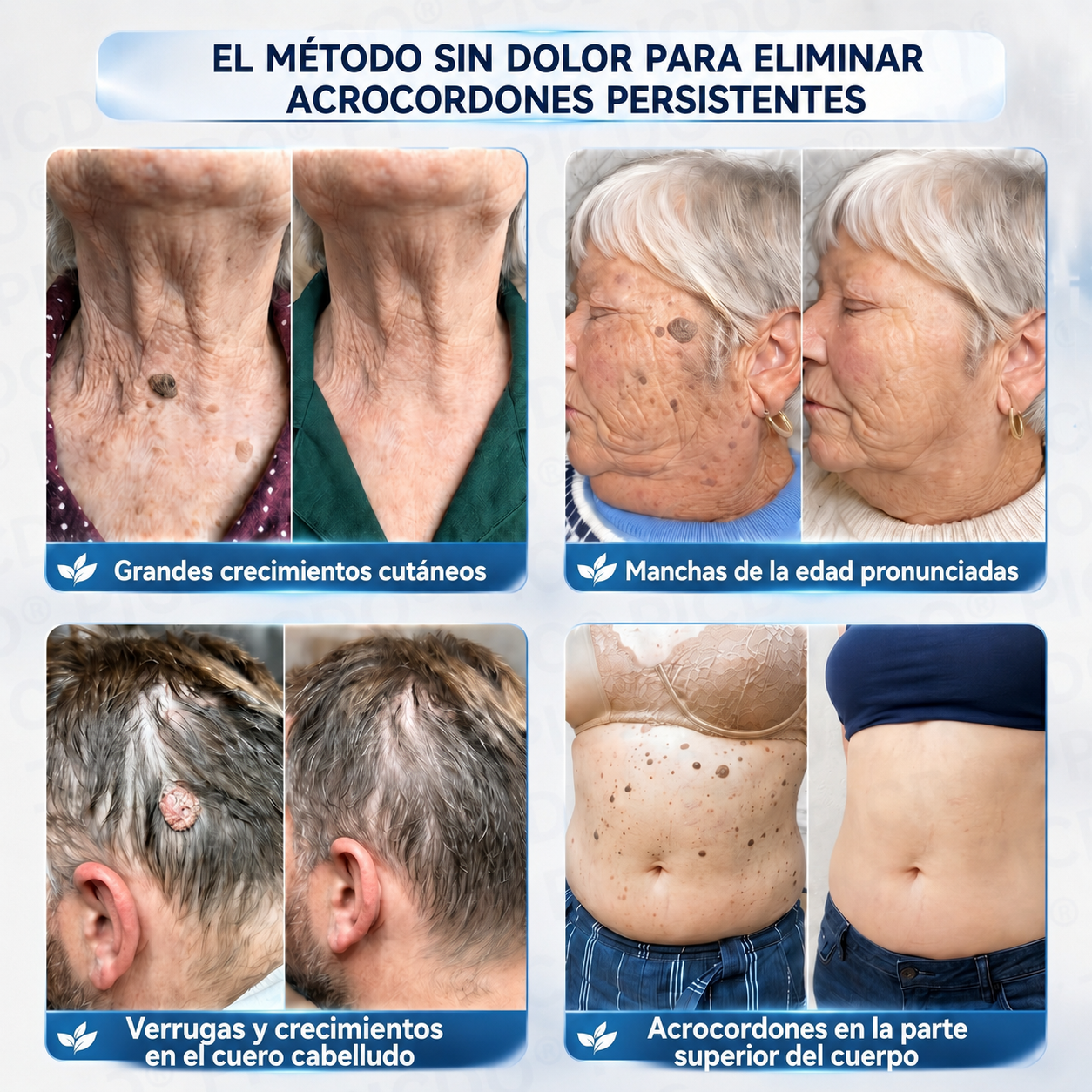 🌌𝐏𝐢𝐜𝐝𝐨® 𝑪𝒓𝒆𝒎𝒂 𝑩𝒐𝒓𝒓𝒂𝒅𝒐𝒓𝒂 𝒅𝒆 𝑨𝒄𝒓𝒐𝒄𝒐𝒓𝒅𝒐𝒏𝒆𝒔 𝒚 𝑴𝒂𝒏𝒄𝒉𝒂𝒔 𝒆𝒏 7 𝑫í𝒂𝒔🩵 (𝐹ó𝑟𝑚𝑢𝑙𝑎 𝑠𝑖𝑛 𝑑𝑜𝑙𝑜𝑟 𝑛𝑖 𝑐𝑖𝑐𝑎𝑡𝑟𝑖𝑐𝑒𝑠) 💪
